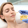 Chin – Honey Waxing<br> 